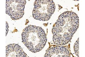 anti-SEL1L adaptor subunit of ERAD E3 ubiquitin ligase (SEL1L) antibody