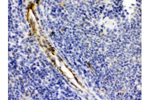 Alpha A Crystallin was detected in paraffin-embedded sections of mouse spleen tissues using rabbit anti- Alpha A Crystallin Antigen Affinity purified polyclonal antibody (Catalog # ) at 1 µg/mL. (CRYAA 抗体  (AA 1-173))