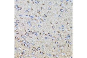 Immunohistochemistry of paraffin-embedded rat brain using R Rabbit mAb (ABIN7269840) at dilution of 1:100 (40x lens). (RALBP1 抗体)