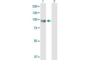 Western Blotting (WB) image for anti-ElaC Homolog 2 (ELAC2) (AA 1-826) antibody (ABIN528451)