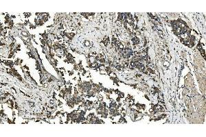 IHC analysis of FLCN using anti-FLCN antibody (ABIN7602491). (FLCN 抗体  (AA 8-551))