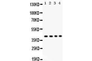 Western Blotting (WB) image for anti-Parvin, alpha (PARVA) (AA 155-185), (Middle Region) antibody (ABIN3043590) (Parvin alpha 抗体  (Middle Region))
