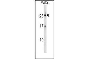 Western blot analysis of KLK12 / Kallikrein-12 Antibody (Center) in WiDr cell line lysates (35ug/lane). (Kallikrein 12 抗体  (Middle Region))