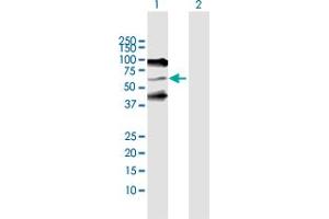 Western Blot analysis of SERPIND1 expression in transfected 293T cell line by SERPIND1 MaxPab polyclonal antibody. (SERPIND1 抗体  (AA 1-499))