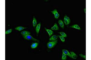 Immunofluorescent analysis of Hela cells using ABIN7158780 at dilution of 1:100 and Alexa Fluor 488-congugated AffiniPure Goat Anti-Rabbit IgG(H+L) (CTSA 抗体  (AA 30-327))