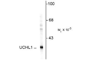 Western blot of rat hippocampal homogenate showing specific immunolabeling of the ~ 24k UCHL1 protein. (UCHL1 抗体)