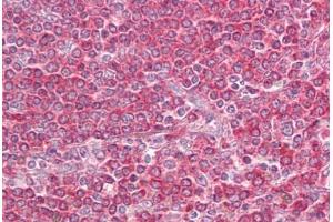 Anti-LY86 / MD-1 antibody IHC staining of human spleen. (LY86 抗体  (AA 112-125))