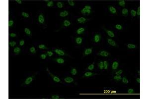 Immunofluorescence of monoclonal antibody to SMAD5 on HeLa cell. (SMAD5 抗体  (AA 105-182))