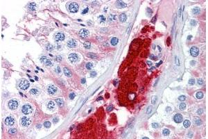 Human Testis: Formalin-Fixed, Paraffin-Embedded (FFPE) (CDC123 抗体  (AA 1-337))