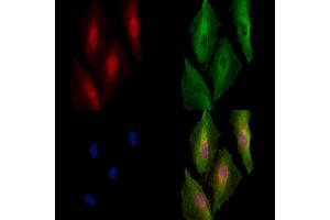 Phospho-beta Catenin (y654) Antibody staining A549 cells(4h of LPS treatment) by IF/ICC.