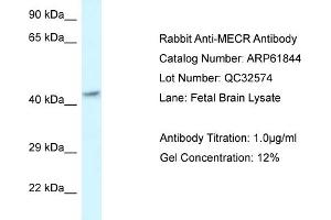 Western Blotting (WB) image for anti-Mitochondrial Trans-2-Enoyl-CoA Reductase (MECR) (C-Term) antibody (ABIN2788923) (MECR 抗体  (C-Term))