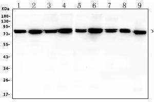 Western blot analysis of MSN using anti-MSN antibody (ABIN7600378). (Moesin 抗体  (AA 184-568))