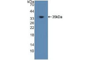 Western blot analysis of recombinant Human TRAF6. (TRAF6 抗体  (AA 153-423))