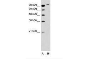 RHOBTB1 anticorps  (C-Term)