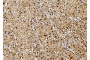 ABIN6258241 and ABIN6274503 at 1/100 staining Human liver tissue by IHC-P. (ILKAP 抗体  (N-Term))