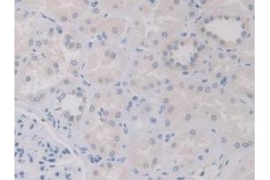 Immunohistochemistry (IHC) image for anti-Interleukin 12 alpha (IL12A) (AA 23-219) antibody (ABIN7430651)