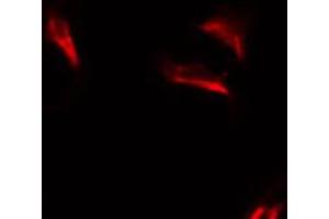ABIN6274633 staining HuvEc by IF/ICC. (COX6C 抗体  (Internal Region))