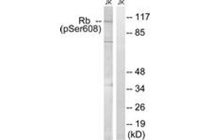Western blot analysis of extracts from Jurkat cells treated with PMA 125ng/ml 30', using Retinoblastoma (Phospho-Ser608) Antibody. (Retinoblastoma Protein (Rb) 抗体  (pSer608))