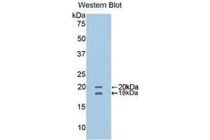 Detection of recombinant CD40L using Polyclonal Antibody to Cluster Of Differentiation 40 Ligand (CD40L) (CD40 Ligand 抗体  (AA 111-261))