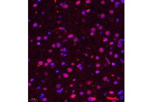 Immunofluorescence of paraffin embedded rat brain using ALS2CR13 (ABIN7073909) at dilution of 1:650 (400x lens) (FAM117B 抗体)