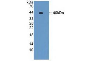 Detection of Recombinant WNK1, Human using Polyclonal Antibody to WNK Lysine Deficient Protein Kinase 1 (WNK1) (WNK1 抗体  (AA 1954-2231))