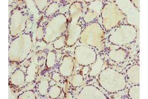 Immunohistochemistry of paraffin-embedded human thyroid tissue using ABIN7147407 at dilution of 1:100 (CEP44 抗体  (AA 1-280))
