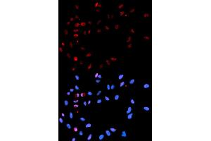 Immunofluorescence analysis of U2OS cells using Phospho-H2AFX-S139 antibody (ABIN5969940). (H2AFX 抗体  (pSer139))