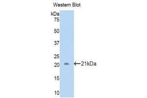 Western Blotting (WB) image for anti-Carbonic Anhydrase 12 (CA12) (AA 161-318) antibody (ABIN1858202) (CA12 抗体  (AA 161-318))