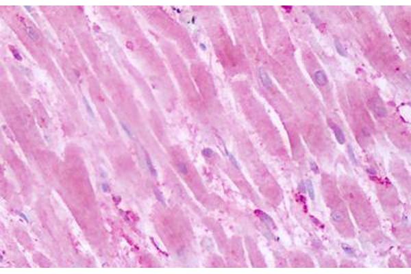 PTPRA 抗体  (Cytoplasmic Domain)