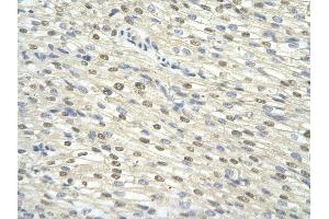 Immunohistochemistry (IHC) image for anti-General Transcription Factor IIH, Polypeptide 3, 34kD (GTF2H3) (N-Term) antibody (ABIN2777299)