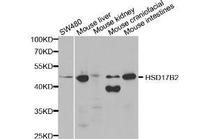 Western blot analysis of extracts of various cell lines, using HSD17B2 antibody. (HSD17B2 抗体)