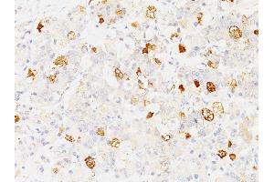 Formalin-fixed, paraffin-embedded human Pituitary stained with FSH-beta Monoclonal Antibody (SPM107). (FSHB 抗体)