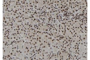 ABIN6261294 and ABIN6273109 at 1/100 staining Human liver tissue by IHC-P. (DHX38 抗体  (C-Term))