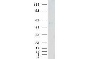 Western Blotting (WB) image for Cyclin-Dependent Kinase 16 (CDK16) (Transcript Variant 1) protein (Myc-DYKDDDDK Tag) (ABIN2713856)