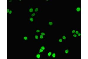 Immunofluorescent analysis of PC-3 cells using ABIN7150213 at dilution of 1:100 and Alexa Fluor 488-congugated AffiniPure Goat Anti-Rabbit IgG(H+L) (TdT 抗体  (AA 1-509))