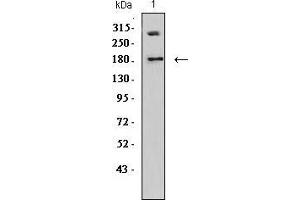 Western Blotting (WB) image for anti-DNA (Cytosine-5)-Methyltransferase 1 (DNMT1) (AA 1317-1616) antibody (ABIN5542512)
