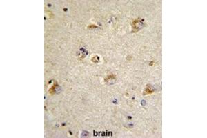 Immunohistochemistry (IHC) image for anti-Cell Division Cycle Associated 3 (CDCA3) antibody (ABIN3002713) (CDCA3 抗体)