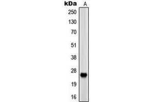 Western blot analysis of EOS expression in HEK293 (A) whole cell lysates. (Eosinophilia, Familial 抗体  (Center))