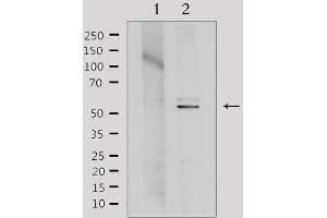 Western blot analysis of extracts from Hela, using TINF2 Antibody. (TINF2 抗体  (Internal Region))