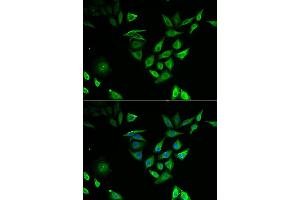 Immunofluorescence analysis of U2OS cell using NUTF2 antibody. (NUTF2 抗体)