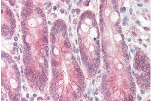 Image no. 2 for anti-Signal Transducing Adaptor Family Member 2 (STAP2) (AA 437-449) antibody (ABIN1492826) (STAP2 抗体  (AA 437-449))