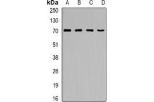 Western blot analysis of CNDP1 expression in A431 (A), HepG2 (B), mouse kidney (C), rat brain (D) whole cell lysates. (CNDP1 抗体)