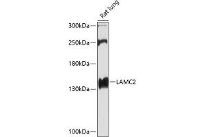 Western blot analysis of extracts of rat lung, using L antibody (ABIN6128174, ABIN6143076, ABIN6143077 and ABIN6219002) at 1:1000 dilution. (LAMC2 抗体  (AA 862-1111))