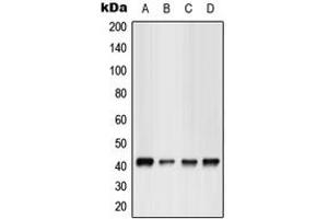 Western blot analysis of GPR17 expression in HEK293T (A), Jurkat (B), NIH3T3 (C), rat kidney (D) whole cell lysates. (GPR17 抗体  (Center))