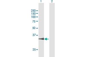Western Blot analysis of PARP16 expression in transfected 293T cell line by PARP16 MaxPab polyclonal antibody. (PARP16 抗体  (AA 1-323))