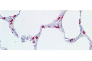 Immunohistochemistry (IHC) image for anti-Lysosomal-Associated Membrane Protein 3 (LAMP3) (AA 222-381) antibody (ABIN7444310)