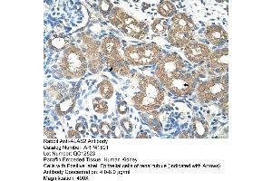 Rabbit Anti-ALAS2 Antibody  Paraffin Embedded Tissue: Human Kidney Cellular Data: Epithelial cells of renal tubule Antibody Concentration: 4. (ALAS2 抗体  (N-Term))