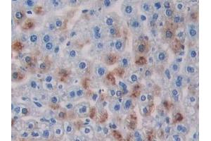 Detection of RIPK3 in Mouse Liver Tissue using Polyclonal Antibody to Receptor Interacting Serine Threonine Kinase 3 (RIPK3) (RIPK3 抗体  (AA 16-239))