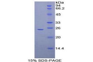 SDS-PAGE analysis of Human Coronin 1A Protein. (Coronin 1a 蛋白)