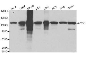Western blot analysis of extracts of various cell lines, using ACTN1 antibody. (ACTN1 抗体  (AA 1-330))